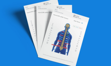 INSiGHT neurological scanning reports