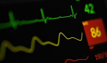 HRV Explained: What SDNN, RMSSD, LF, HF, and Other Heart Rate Variability Metrics Actually Mean